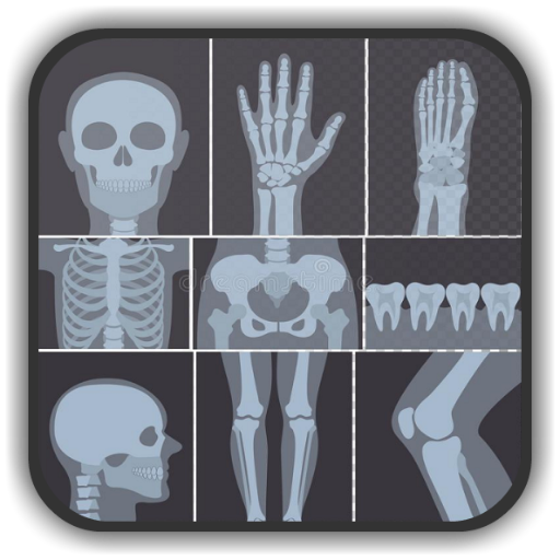 X-ray Interpretation for Medic 2.9